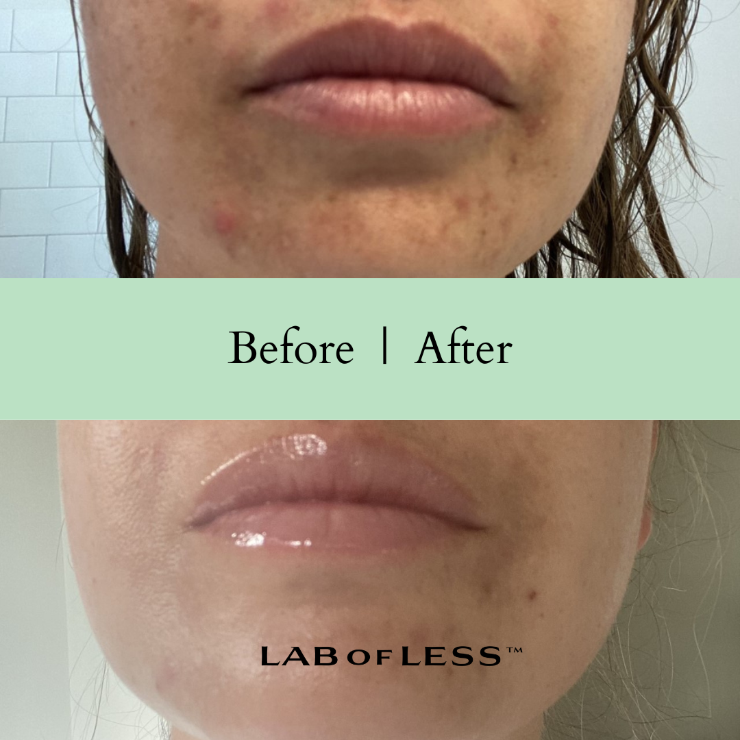 'Everywhere' Antioxidant Oil Face + Body + Hair